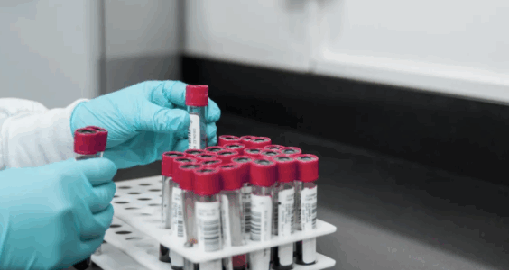 知识分子｜血铅事件背后，670万儿童铅暴露风险被低估