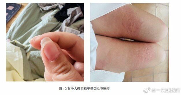 【404文库】红星新闻｜宽娱公司前员工称出差期间遭性侵，男方被刑拘后不予起诉，检方认为现有证据无法证明存暴力胁迫原创