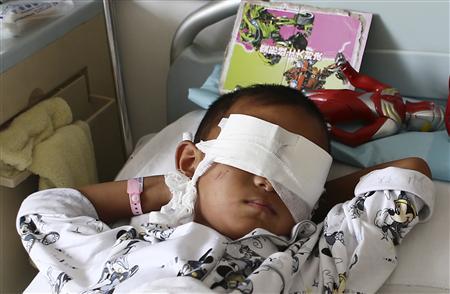 6-Year-Old’s Eyes Gouged Out, Possibly for Corneas