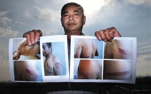 U.N. Report: Chinese Justice System Relies on Torture