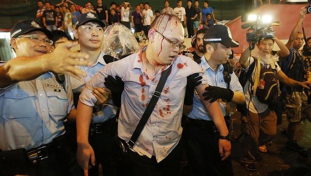 Protest Camps in Hong Kong Come Under Assault